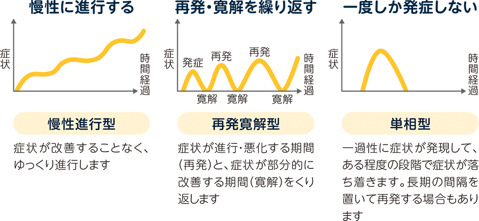 CIDPはどのように進行するの？