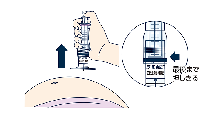 薬液を全量注入したことを確認した後に、皮膚をつまんでいた手をはなし、注射針を刺した角度と同じ角度で抜きます。