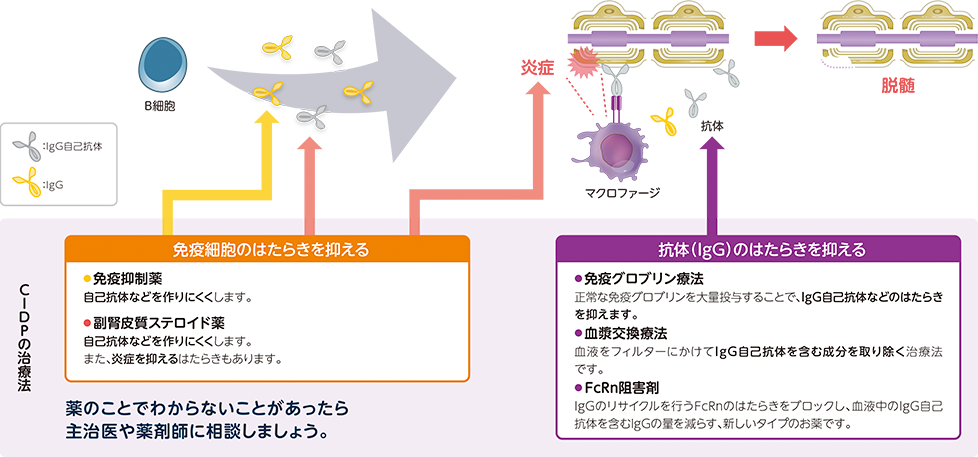 CIDPの治療法について