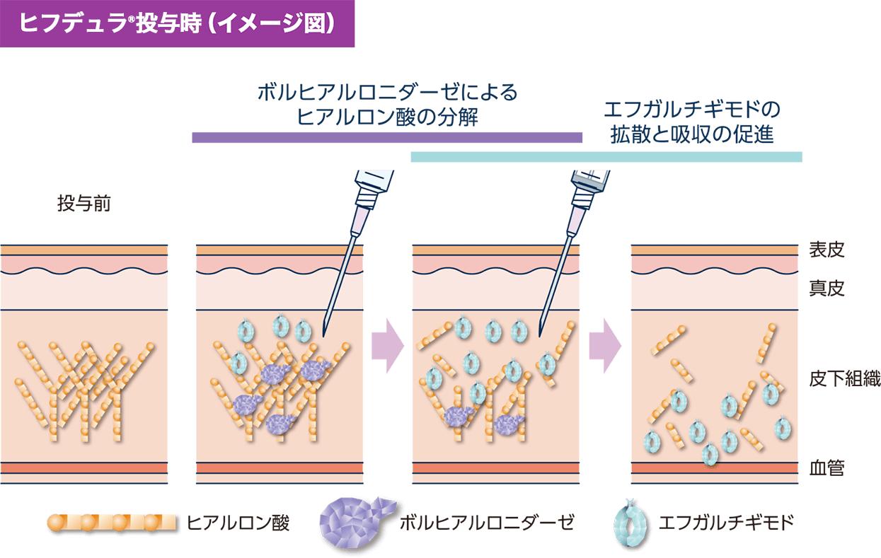 ヒフデュラ投与時（イメージ図）